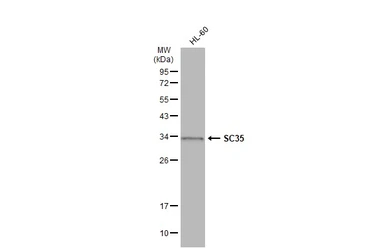 Anti-SC35 antibody used in Western Blot (WB). GTX130950