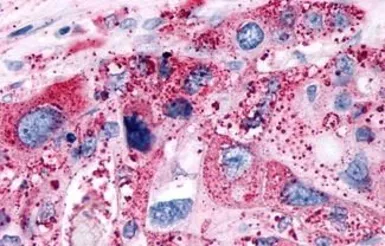 Anti-P2Y6 antibody used in IHC (Paraffin sections) (IHC-P). GTX13106