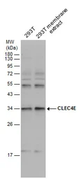 Anti-CLEC4E antibody used in Western Blot (WB). GTX131096