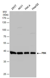 Anti-PBK antibody used in Western Blot (WB). GTX131112