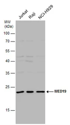 Anti-MED19 antibody used in Western Blot (WB). GTX131181