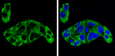 Anti-Alpha fetoprotein / AFP antibody used in Immunocytochemistry/ Immunofluorescence (ICC/IF). GTX131311