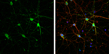 Anti-HCN1 antibody used in Immunocytochemistry/ Immunofluorescence (ICC/IF). GTX131334