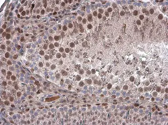 Anti-Brachyury antibody used in IHC (Paraffin sections) (IHC-P). GTX131339