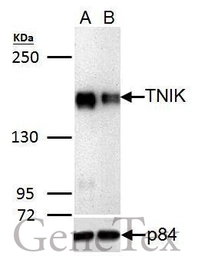 Anti-TNIK antibody used in Western Blot (WB). GTX13141