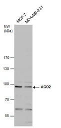Anti-EIF2C2 antibody used in Western Blot (WB). GTX131422
