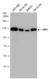 Anti-HIP1 antibody used in Western Blot (WB). GTX131449