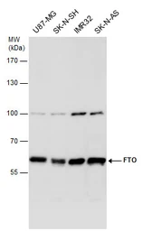 Anti-FTO antibody used in Western Blot (WB). GTX131517