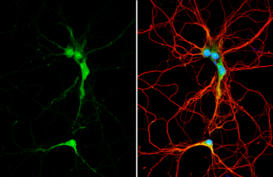 Anti-FTO antibody used in Immunocytochemistry/ Immunofluorescence (ICC/IF). GTX131517