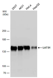 Anti-LATS1 antibody used in Western Blot (WB). GTX131532