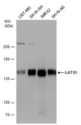 Anti-LATS1 antibody used in Western Blot (WB). GTX131532