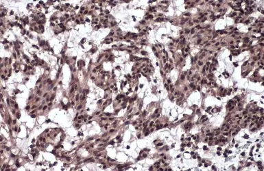 Anti-TIF1 gamma antibody used in IHC (Paraffin sections) (IHC-P). GTX131686