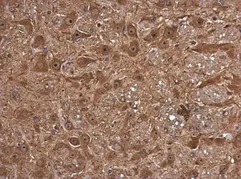 Anti-FSD1 antibody used in IHC (Paraffin sections) (IHC-P). GTX131769