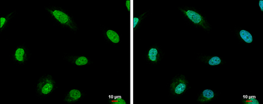 Anti-RIF1 antibody used in Immunocytochemistry/ Immunofluorescence (ICC/IF). GTX131889