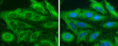 Anti-Acetyl-CoA Carboxylase 1 antibody used in Immunocytochemistry/ Immunofluorescence (ICC/IF). GTX132081