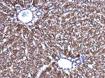 Anti-Acetyl-CoA Carboxylase 1 antibody used in IHC (Paraffin sections) (IHC-P). GTX132081