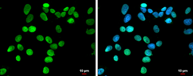 Anti-HMGA1 antibody used in Immunocytochemistry/ Immunofluorescence (ICC/IF). GTX132110