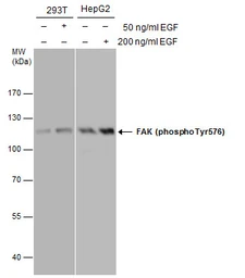 Anti-FAK (phospho Tyr576) antibody used in Western Blot (WB). GTX132140