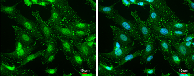 Anti-FAK (phospho Tyr576) antibody used in Immunocytochemistry/ Immunofluorescence (ICC/IF). GTX132140