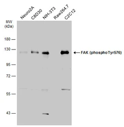 Anti-FAK (phospho Tyr576) antibody used in Western Blot (WB). GTX132140