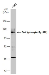 Anti-FAK (phospho Tyr576) antibody used in Western Blot (WB). GTX132140