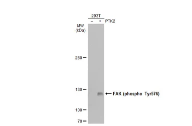 Anti-FAK (phospho Tyr576) antibody used in Western Blot (WB). GTX132140