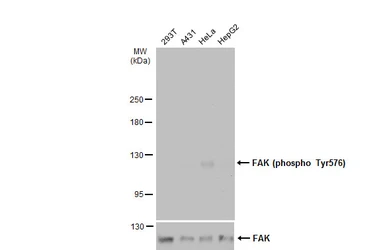 Anti-FAK (phospho Tyr576) antibody used in Western Blot (WB). GTX132140