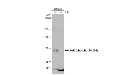 Anti-FAK (phospho Tyr576) antibody used in Western Blot (WB). GTX132140