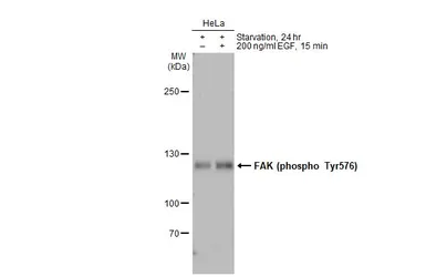 Anti-FAK (phospho Tyr576) antibody used in Western Blot (WB). GTX132140