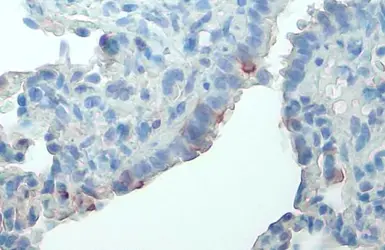 Anti-FAK (phospho Tyr576) antibody used in IHC (Paraffin sections) (IHC-P). GTX132140