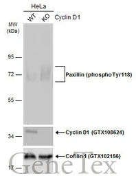 Anti-Paxillin (phospho Tyr118) antibody used in Western Blot (WB). GTX132152