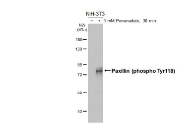 Anti-Paxillin (phospho Tyr118) antibody used in Western Blot (WB). GTX132152