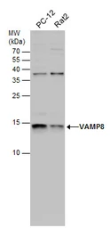Anti-VAMP8 antibody used in Western Blot (WB). GTX132181
