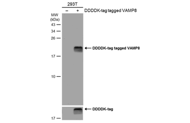 Anti-VAMP8 antibody used in Western Blot (WB). GTX132181