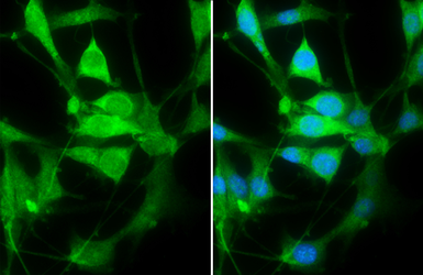 Anti-PHD2 antibody used in Immunocytochemistry/ Immunofluorescence (ICC/IF). GTX132293