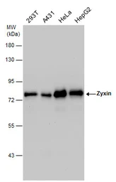 Anti-Zyxin antibody used in Western Blot (WB). GTX132295