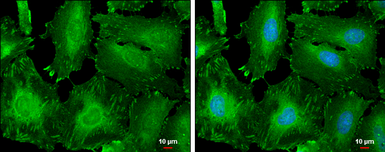 Anti-Zyxin antibody used in Immunocytochemistry/ Immunofluorescence (ICC/IF). GTX132295
