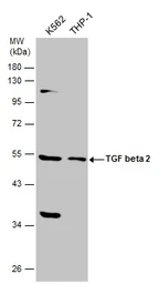Anti-TGF beta 2 antibody used in Western Blot (WB). GTX132546