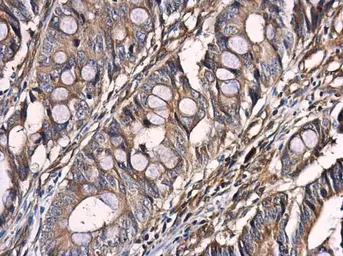 Anti-Optineurin antibody used in IHC (Paraffin sections) (IHC-P). GTX132575