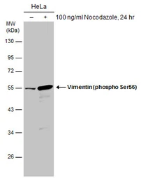 Anti-Vimentin (phospho Ser56) antibody used in Western Blot (WB). GTX132607