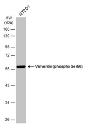 Anti-Vimentin (phospho Ser56) antibody used in Western Blot (WB). GTX132607