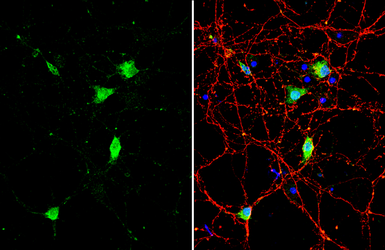 Anti-BDNF antibody used in Immunocytochemistry/ Immunofluorescence (ICC/IF). GTX132621