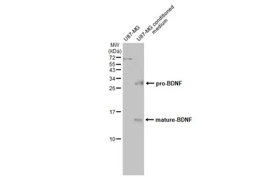 Anti-BDNF antibody used in Western Blot (WB). GTX132621