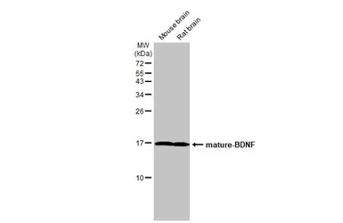 Anti-BDNF antibody used in Western Blot (WB). GTX132621