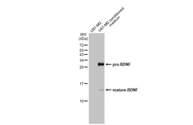 Anti-BDNF antibody used in Western Blot (WB). GTX132621