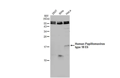 Anti-Human Papillomavirus type 18 E6 antibody used in Western Blot (WB). GTX132687