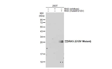 Anti-RAS (G12V Mutant) antibody used in Western Blot (WB). GTX132695