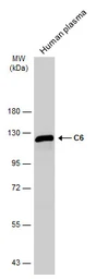 Anti-C6 antibody used in Western Blot (WB). GTX132704