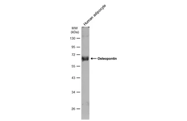 Anti-Osteopontin antibody used in Western Blot (WB). GTX132742