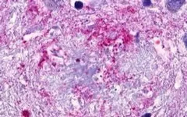 Anti-SREB3 antibody used in IHC (Paraffin sections) (IHC-P). GTX13277